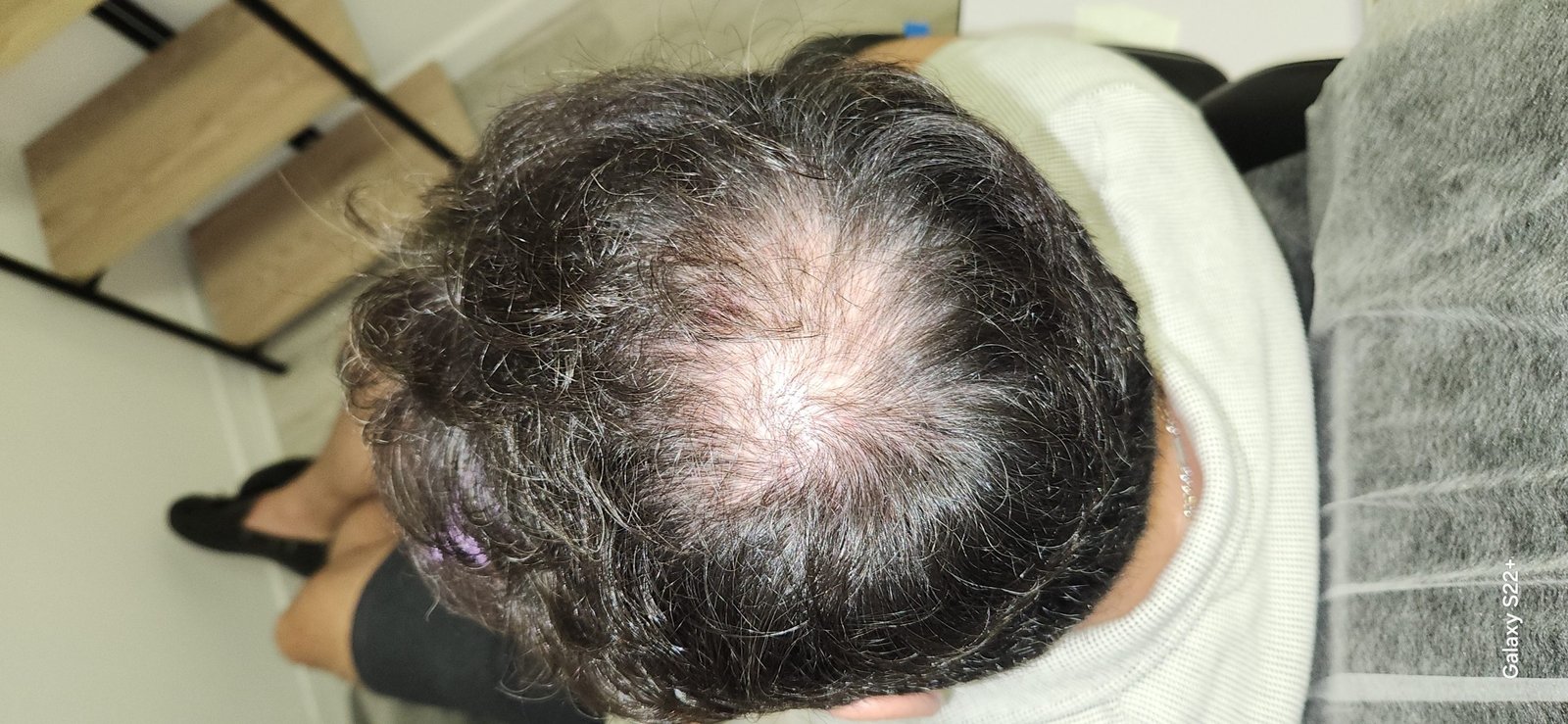 Before image