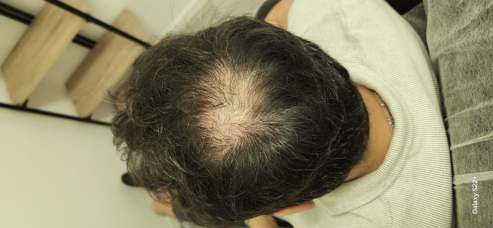 After image