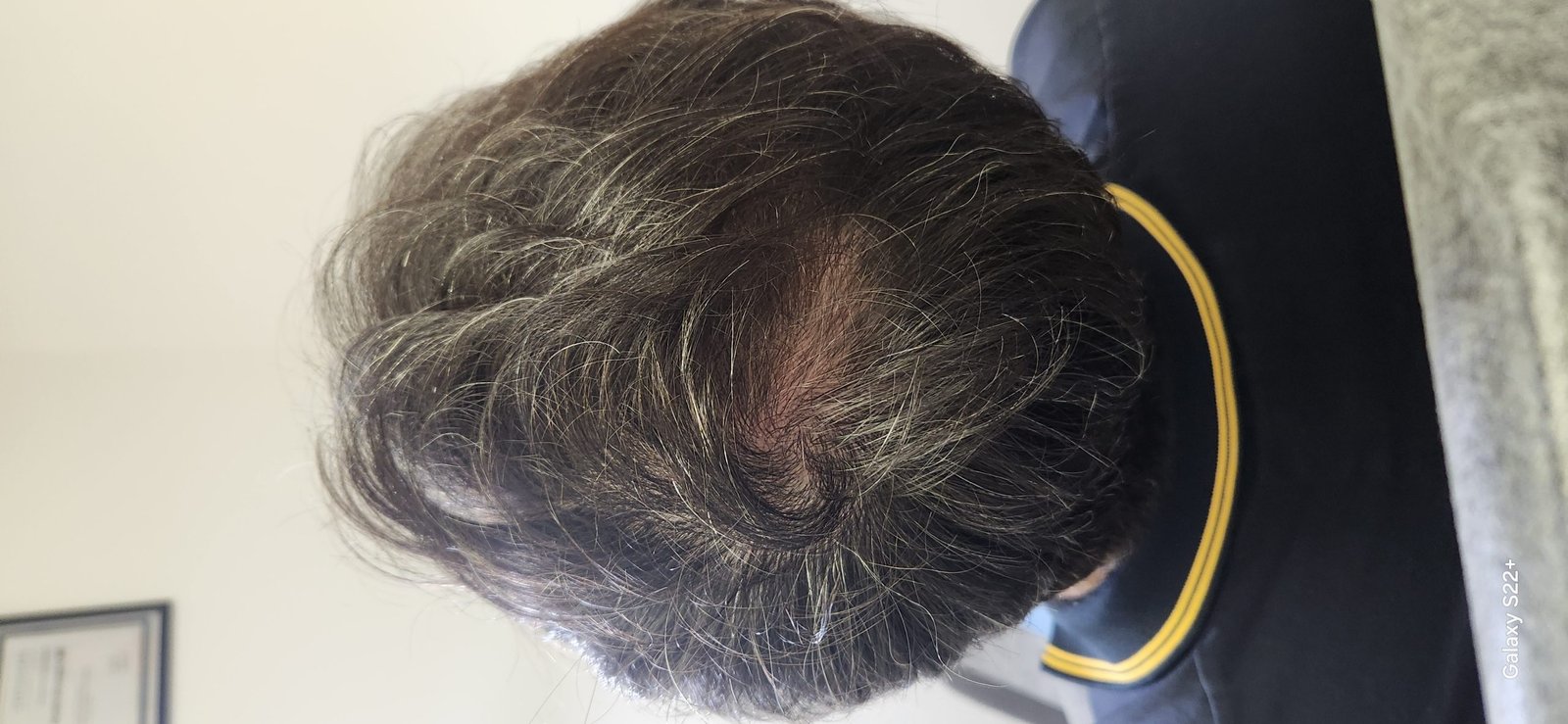 After image