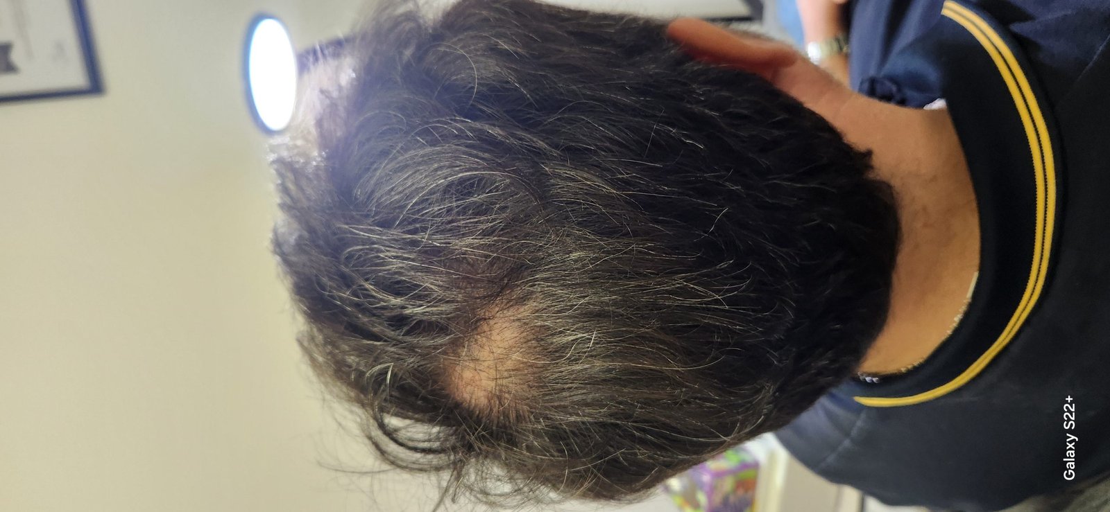 Before image