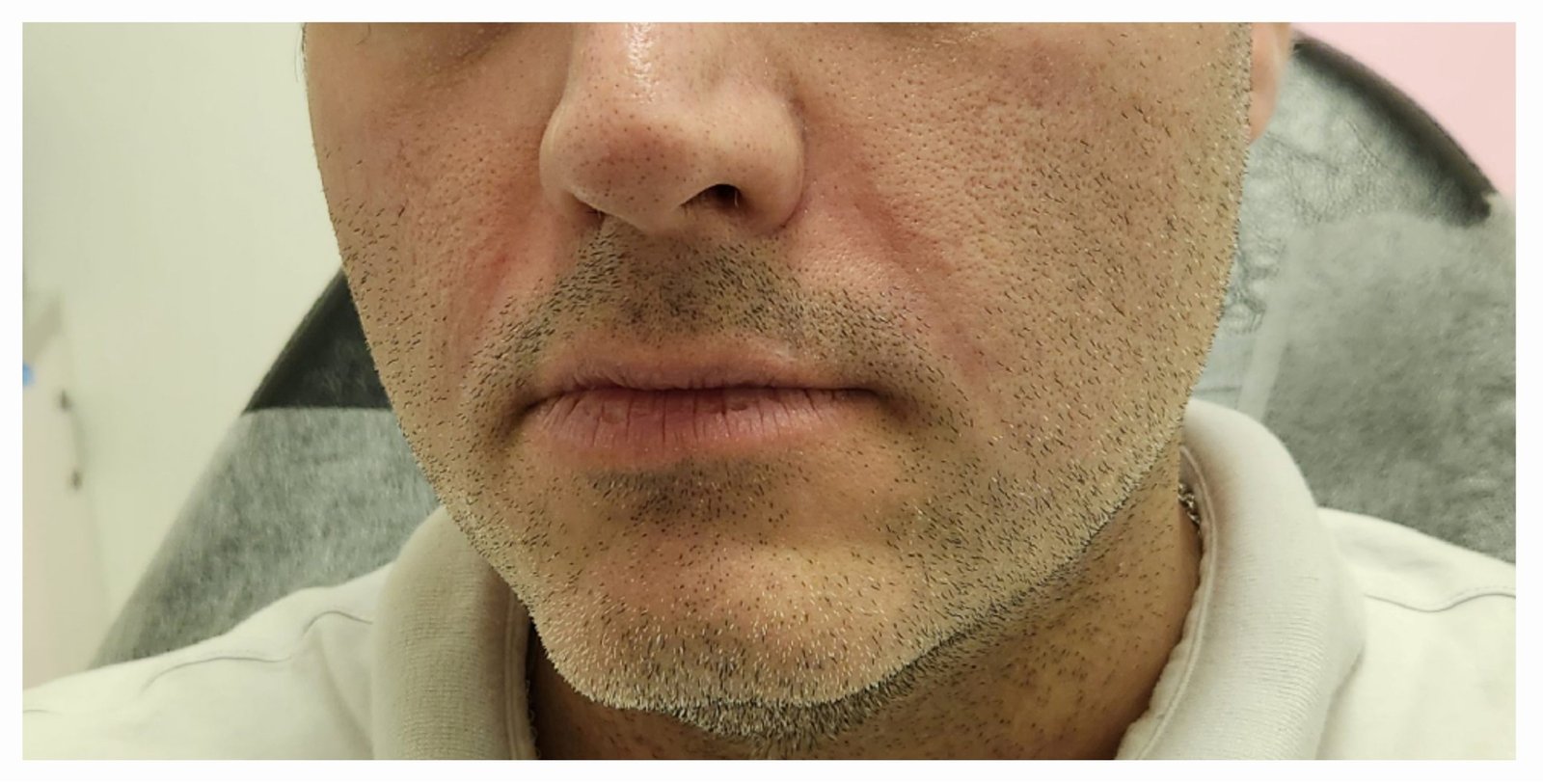 Before image